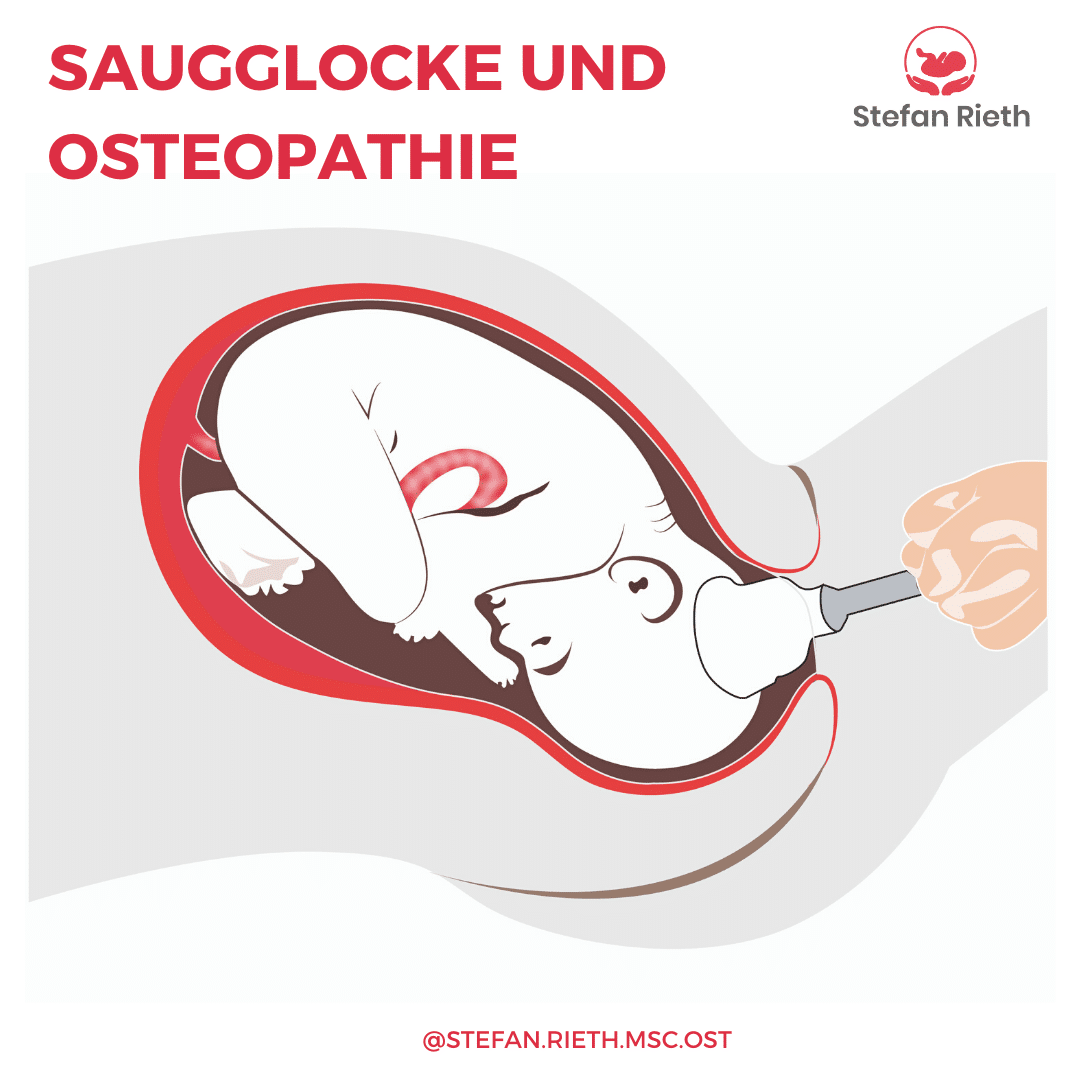 DIE SAUGGLOCKE UND WAS SIE MIT DEINEM KIND MACHT Stefan Rieth